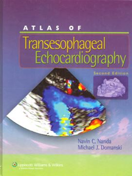 Imagem de ATLAS OF TRANSESOPHAGEAL ECHOCARDIOGRAPHY - 2ND ED